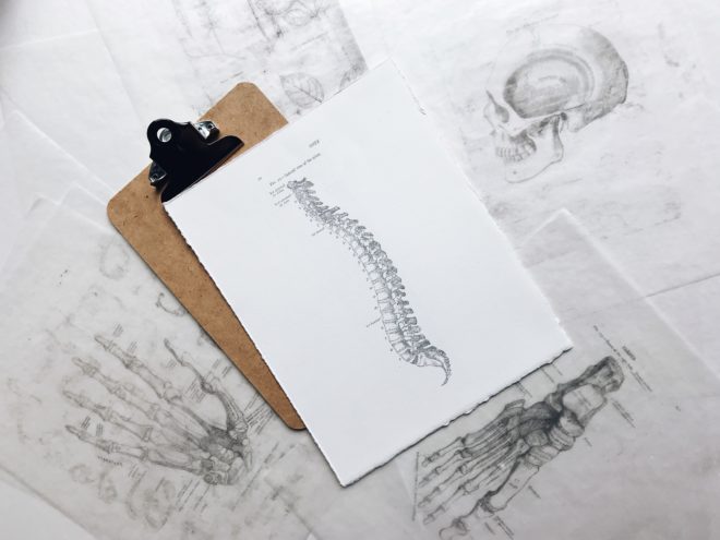 laminectomy or fusion … the woes of my spine